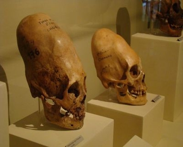 Az eltorzított koponyák